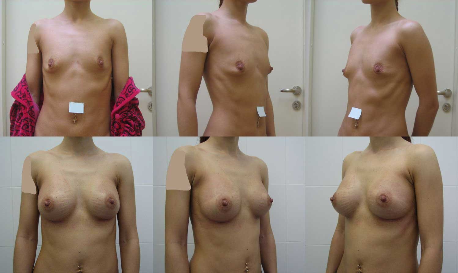 от секса увеличивается грудь у женщин фото 13